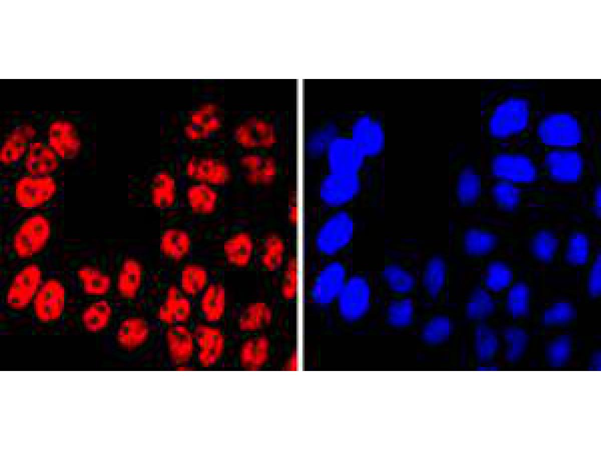 ICC staining of MiTF in A431 cells (red). Formalin fixed cells were permeabilized with 0.1% Triton X-100 in TBS for 10 minutes at room temperature and blocked with 1% Blocker BSA for 15 minutes at room temperature. Cells were probed with the primary antibody (ET1702-86, 1/50) for 1 hour at room temperature, washed with PBS. Alexa Fluor®594 Goat anti-Rabbit IgG was used as the secondary antibody at 1/1,000 dilution. The nuclear counter stain is DAPI (blue).