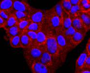 ICC staining alpha 1 Antitrypsin in Hela cells (red). The nuclear counter stain is DAPI (blue). Cells were fixed in paraformaldehyde, permeabilised with 0.25% Triton X100/PBS.