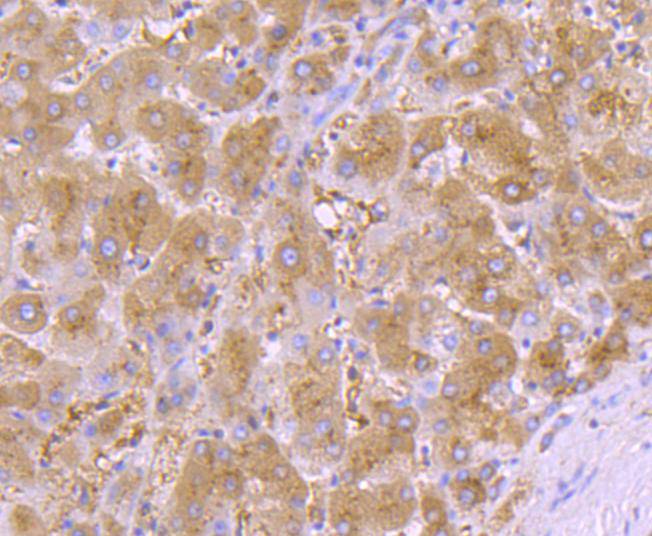 Immunohistochemical analysis of paraffin-embedded human liver tissue using anti-alpha 1 Antitrypsin antibody. Counter stained with hematoxylin.