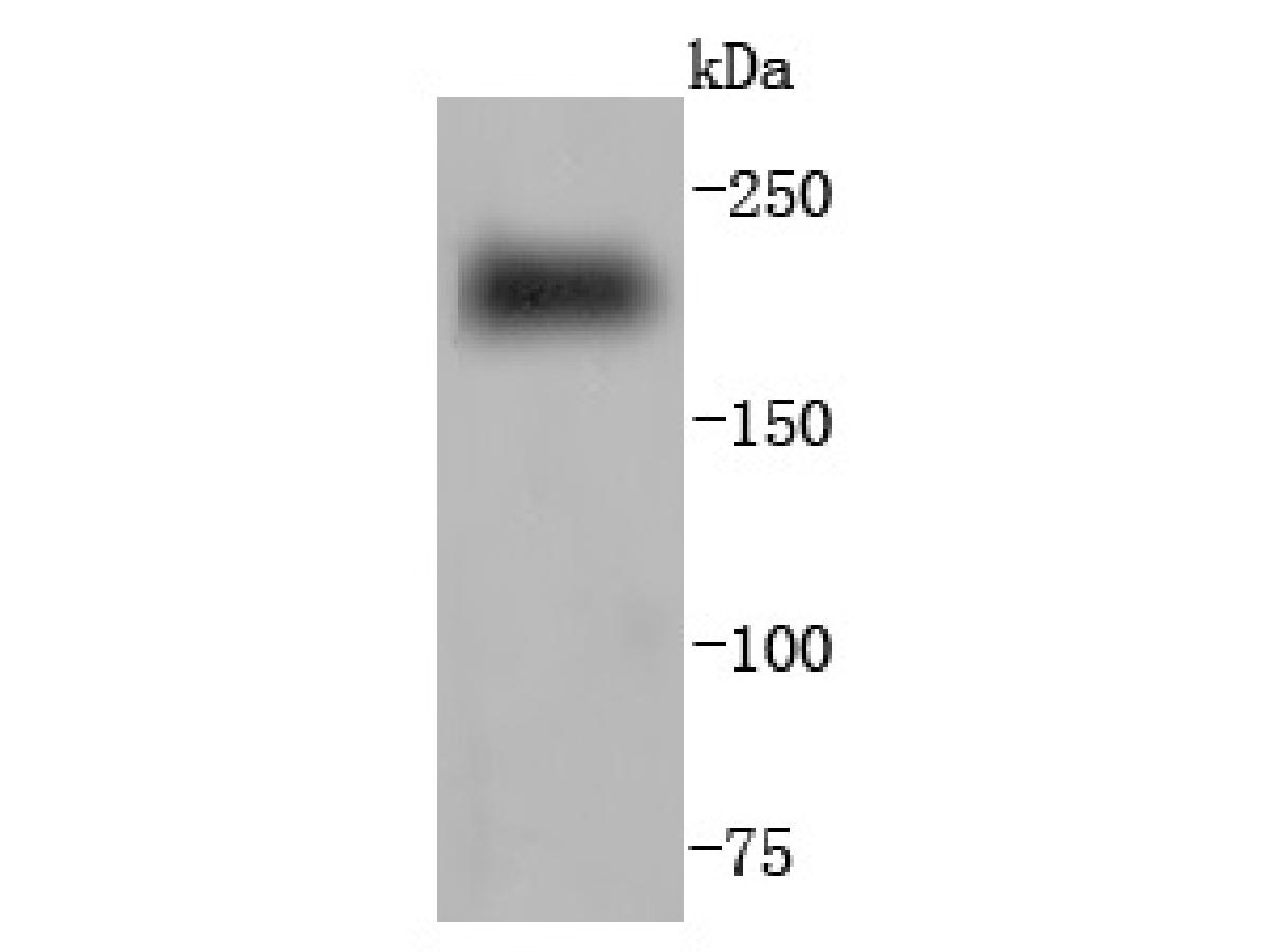 Myosin heavy chain Recombinant Rabbit Monoclonal Antibody [JF097-7 