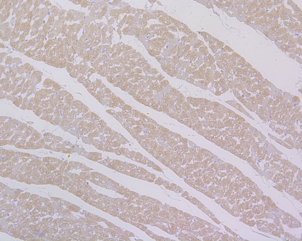 Immunohistochemical analysis of paraffin-embedded rat heart tissue using anti-Myosin heavy chain antibody. The section was pre-treated using heat mediated antigen retrieval with Tris-EDTA buffer (pH 8.0-8.4) for 20 minutes.The tissues were blocked in 5% BSA for 30 minutes at room temperature, washed with ddH2O and PBS, and then probed with the primary antibody (ET1702-88, 1/400) for 30 minutes at room temperature. The detection was performed using an HRP conjugated compact polymer system. DAB was used as the chromogen. Tissues were counterstained with hematoxylin and mounted with DPX.