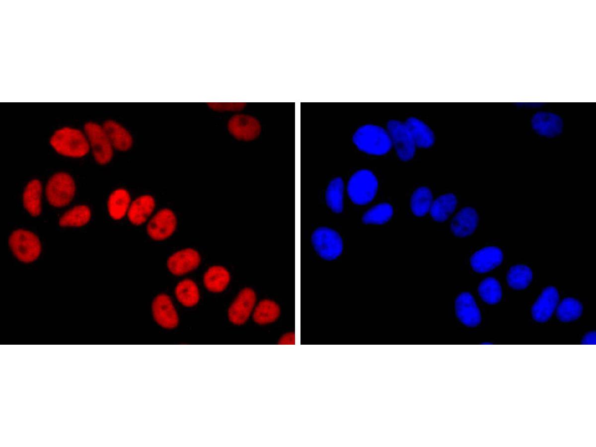 ICC staining of FOXA1 in MCF-7 cells (red). Formalin fixed cells were permeabilized with 0.1% Triton X-100 in TBS for 10 minutes at room temperature and blocked with 10% negative goat serum for 15 minutes at room temperature. Cells were probed with the primary antibody (ET1702-89, 1/50) for 1 hour at room temperature, washed with PBS. Alexa Fluor®594 conjugate-Goat anti-Rabbit IgG was used as the secondary antibody at 1/1,000 dilution. The nuclear counter stain is DAPI (blue).