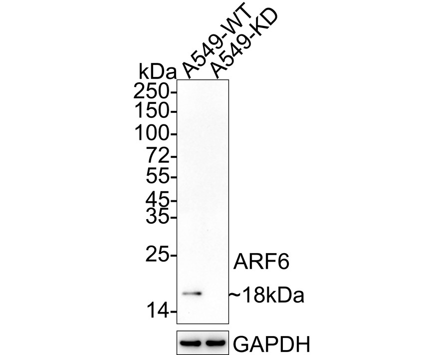 Western blot analysis of ARF6 on human liver tissue lysates. Proteins were transferred to a PVDF membrane and blocked with 5% BSA in PBS for 1 hour at room temperature. The primary antibody (ET1702-91, 1/500) was used in 5% BSA at room temperature for 2 hours. Goat Anti-Rabbit IgG - HRP Secondary Antibody (HA1001) at 1:50,000 dilution was used for 1 hour at room temperature.