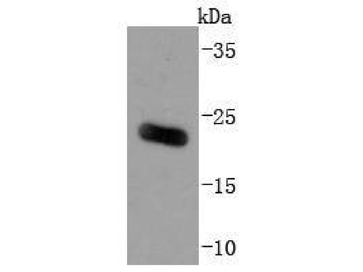ICC staining of ARF6 in Hela cells (red). Formalin fixed cells were permeabilized with 0.1% Triton X-100 in TBS for 10 minutes at room temperature and blocked with 1% Blocker BSA for 15 minutes at room temperature. Cells were probed with the primary antibody (ET1702-91, 1/50) for 1 hour at room temperature, washed with PBS. Alexa Fluor®594 Goat anti-Rabbit IgG was used as the secondary antibody at 1/1,000 dilution. The nuclear counter stain is DAPI (blue).