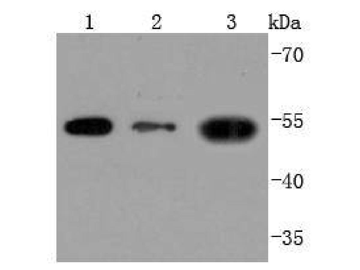 Western blot analysis of THY1 on different lysates. Proteins were transferred to a PVDF membrane and blocked with 5% BSA in PBS for 1 hour at room temperature. The primary antibody (ET1702-92, 1/500) was used in 5% BSA at room temperature for 2 hours. Goat Anti-Rabbit IgG - HRP Secondary Antibody (HA1001) at 1:200,000 dilution was used for 1 hour at room temperature.<br />
Positive control: <br />
Lane 1: Hela cell lysate<br />
Lane 2: HepG2 cell lysate<br />
Lane 3: HUVEC cell lysate