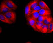 ICC staining of THY1 in Hela cells (red). Formalin fixed cells were permeabilized with 0.1% Triton X-100 in TBS for 10 minutes at room temperature and blocked with 10% negative goat serum for 15 minutes at room temperature. Cells were probed with the primary antibody (ET1702-92, 1/50) for 1 hour at room temperature, washed with PBS. Alexa Fluor®594 conjugate-Goat anti-Rabbit IgG was used as the secondary antibody at 1/1,000 dilution. The nuclear counter stain is DAPI (blue).