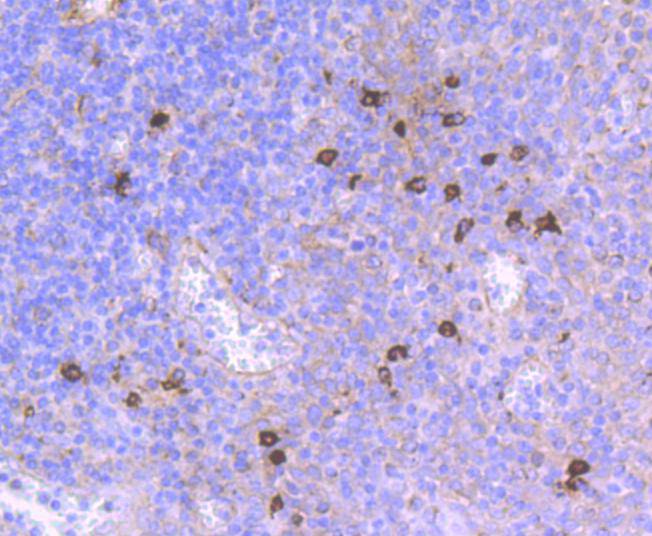 Immunohistochemical analysis of paraffin-embedded human tonsil tissue using anti-THY1 antibody. The section was pre-treated using heat mediated antigen retrieval with Tris-EDTA buffer (pH 9.0) for 20 minutes.The tissues were blocked in 5% BSA for 30 minutes at room temperature, washed with ddH2O and PBS, and then probed with the primary antibody (ET1702-92, 1/50) for 30 minutes at room temperature. The detection was performed using an HRP conjugated compact polymer system. DAB was used as the chromogen. Tissues were counterstained with hematoxylin and mounted with DPX.