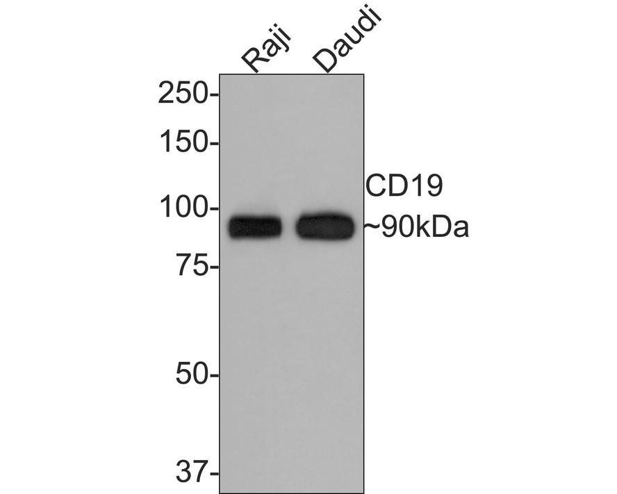 Western blot analysis of CD19 on Raji cell lysates. Proteins were transferred to a PVDF membrane and blocked with 5% BSA in PBS for 1 hour at room temperature. The primary antibody (ET1702-93, 1/500) was used in 5% BSA at room temperature for 2 hours. Goat Anti-Rabbit IgG - HRP Secondary Antibody (HA1001) at 1:200,000 dilution was used for 1 hour at room temperature.