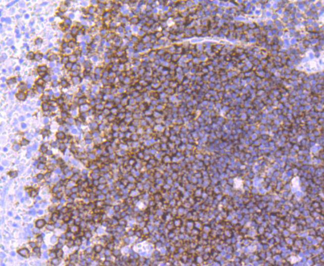 Immunohistochemical analysis of paraffin-embedded human spleen tissue using anti-CD19 antibody. The section was pre-treated using heat mediated antigen retrieval with Tris-EDTA buffer (pH 9.0) for 20 minutes.The tissues were blocked in 1% BSA for 30 minutes at room temperature, washed with ddH2O and PBS, and then probed with the primary antibody (ET1702-93, 1/50) for 30 minutes at room temperature. The detection was performed using an HRP conjugated compact polymer system. DAB was used as the chromogen. Tissues were counterstained with hematoxylin and mounted with DPX.