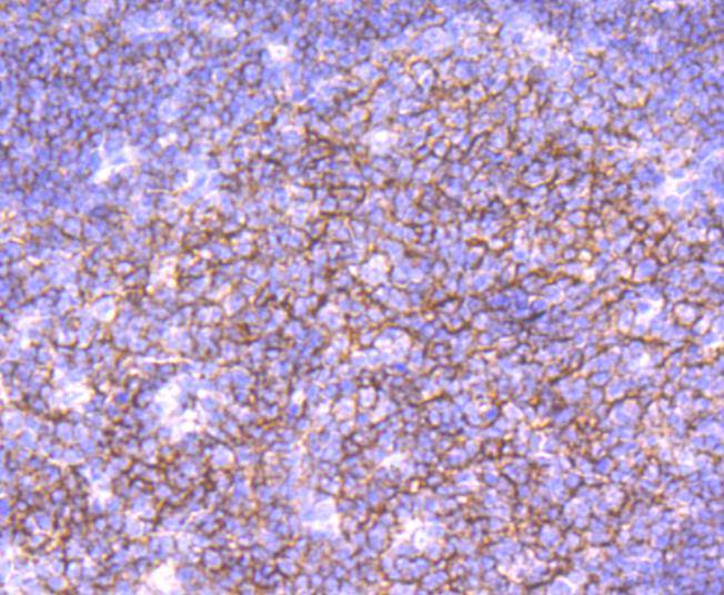 Immunohistochemical analysis of paraffin-embedded human tonsil tissue using anti-CD19 antibody. The section was pre-treated using heat mediated antigen retrieval with Tris-EDTA buffer (pH 9.0) for 20 minutes.The tissues were blocked in 1% BSA for 30 minutes at room temperature, washed with ddH2O and PBS, and then probed with the primary antibody (ET1702-93, 1/50) for 30 minutes at room temperature. The detection was performed using an HRP conjugated compact polymer system. DAB was used as the chromogen. Tissues were counterstained with hematoxylin and mounted with DPX.
