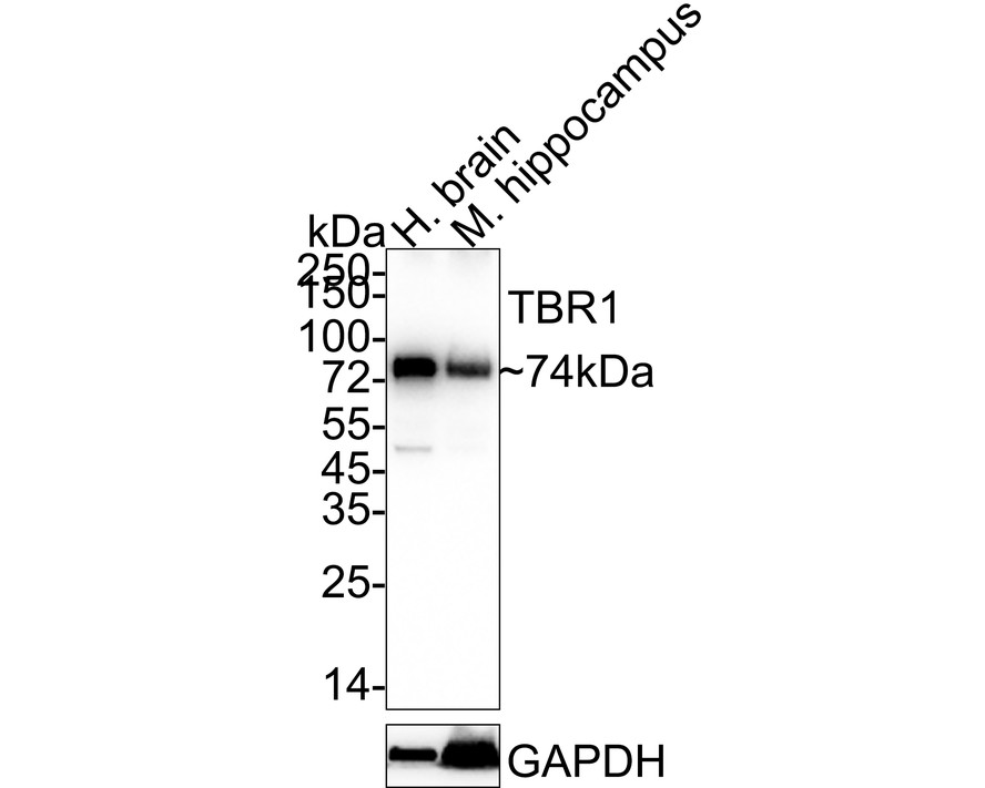 Western blot analysis of TBR1 on mouse brain tissue lysates. Proteins were transferred to a PVDF membrane and blocked with 5% BSA in PBS for 1 hour at room temperature. The primary antibody (ET1702-97, 1/500) was used in 5% BSA at room temperature for 2 hours. Goat Anti-Rabbit IgG - HRP Secondary Antibody (HA1001) at 1:200,000 dilution was used for 1 hour at room temperature.