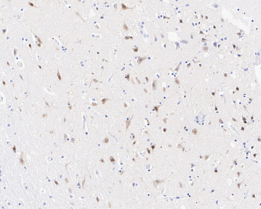 Immunohistochemical analysis of paraffin-embedded rat brain tissue with Rabbit anti-TBR1 antibody (ET1702-97) at 1/500 dilution.<br />
<br />
The section was pre-treated using heat mediated antigen retrieval with sodium citrate buffer (pH 6.0) for 2 minutes. The tissues were blocked in 1% BSA for 20 minutes at room temperature, washed with ddH2O and PBS, and then probed with the primary antibody (ET1702-97) at 1/500 dilution for 1 hour at room temperature. The detection was performed using an HRP conjugated compact polymer system. DAB was used as the chromogen. Tissues were counterstained with hematoxylin and mounted with DPX.