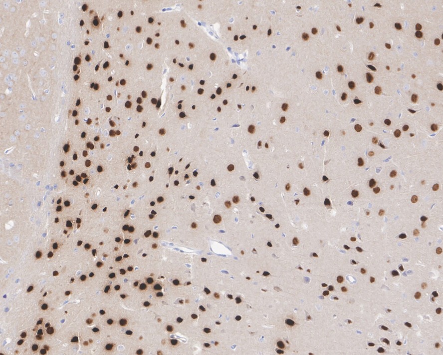 Immunohistochemical analysis of paraffin-embedded mouse brain tissue with Rabbit anti-TBR1 antibody (ET1702-97) at 1/500 dilution.<br />
<br />
The section was pre-treated using heat mediated antigen retrieval with sodium citrate buffer (pH 6.0) for 2 minutes. The tissues were blocked in 1% BSA for 20 minutes at room temperature, washed with ddH2O and PBS, and then probed with the primary antibody (ET1702-97) at 1/500 dilution for 1 hour at room temperature. The detection was performed using an HRP conjugated compact polymer system. DAB was used as the chromogen. Tissues were counterstained with hematoxylin and mounted with DPX.