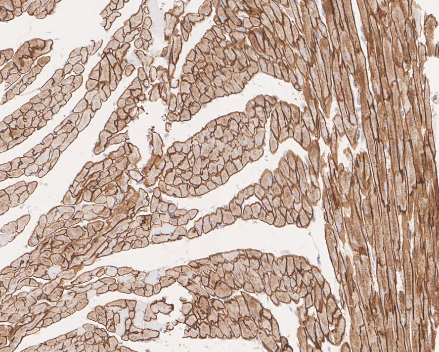 Immunohistochemical analysis of paraffin-embedded rat heart tissue with Rabbit anti-Dystrophin antibody (ET1702-98) at 1/400 dilution.<br />
<br />
The section was pre-treated using heat mediated antigen retrieval with Tris-EDTA buffer (pH 9.0) for 20 minutes. The tissues were blocked in 1% BSA for 20 minutes at room temperature, washed with ddH2O and PBS, and then probed with the primary antibody (ET1702-98) at 1/400 dilution for 1 hour at room temperature. The detection was performed using an HRP conjugated compact polymer system. DAB was used as the chromogen. Tissues were counterstained with hematoxylin and mounted with DPX.