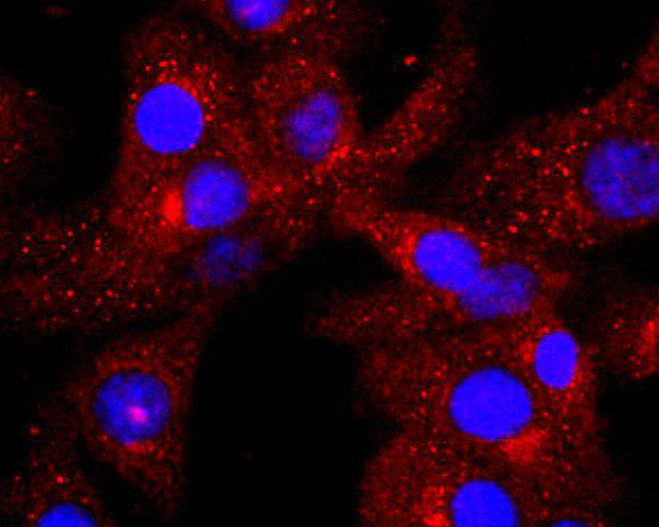 ICC staining of C3 in NIH/3T3 cells (red). Formalin fixed cells were permeabilized with 0.1% Triton X-100 in TBS for 10 minutes at room temperature and blocked with 1% Blocker BSA for 15 minutes at room temperature. Cells were probed with the primary antibody (ET1702-99, 1/50) for 1 hour at room temperature, washed with PBS. Alexa Fluor®594 Goat anti-Rabbit IgG was used as the secondary antibody at 1/1,000 dilution. The nuclear counter stain is DAPI (blue).