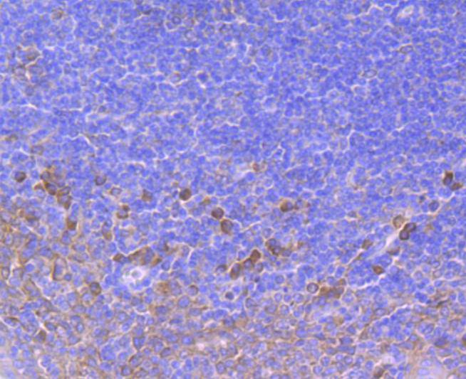 Immunohistochemical analysis of paraffin-embedded human kidney tissue using anti-SERCA2 antibody. The section was pre-treated using heat mediated antigen retrieval with Tris-EDTA buffer (pH 8.0-8.4) for 20 minutes.The tissues were blocked in 5% BSA for 30 minutes at room temperature, washed with ddH2O and PBS, and then probed with the primary antibody (ET1703-01, 1/50) for 30 minutes at room temperature. The detection was performed using an HRP conjugated compact polymer system. DAB was used as the chromogen. Tissues were counterstained with hematoxylin and mounted with DPX.
