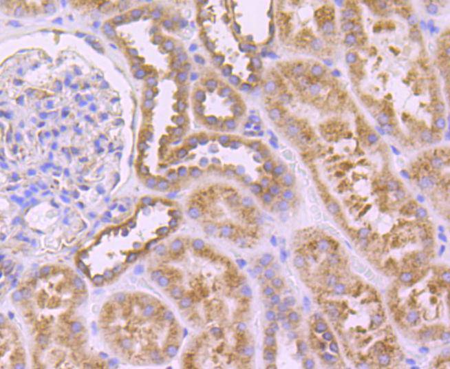 Immunohistochemical analysis of paraffin-embedded mouse skeletal muscle tissue using anti-SERCA2 antibody. The section was pre-treated using heat mediated antigen retrieval with Tris-EDTA buffer (pH 8.0-8.4) for 20 minutes.The tissues were blocked in 5% BSA for 30 minutes at room temperature, washed with ddH2O and PBS, and then probed with the primary antibody (ET1703-01, 1/50) for 30 minutes at room temperature. The detection was performed using an HRP conjugated compact polymer system. DAB was used as the chromogen. Tissues were counterstained with hematoxylin and mounted with DPX.
