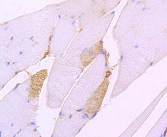 Immunohistochemical analysis of paraffin-embedded mouse skin tissue using anti-SERCA2 antibody. The section was pre-treated using heat mediated antigen retrieval with Tris-EDTA buffer (pH 8.0-8.4) for 20 minutes.The tissues were blocked in 5% BSA for 30 minutes at room temperature, washed with ddH2O and PBS, and then probed with the primary antibody (ET1703-01, 1/50) for 30 minutes at room temperature. The detection was performed using an HRP conjugated compact polymer system. DAB was used as the chromogen. Tissues were counterstained with hematoxylin and mounted with DPX.