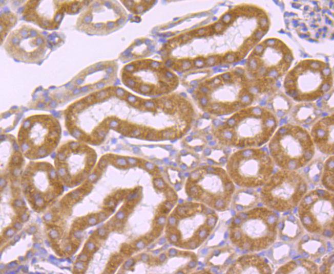 Immunohistochemical analysis of paraffin-embedded mouse heart tissue using anti-SERCA2 antibody. The section was pre-treated using heat mediated antigen retrieval with Tris-EDTA buffer (pH 8.0-8.4) for 20 minutes.The tissues were blocked in 5% BSA for 30 minutes at room temperature, washed with ddH2O and PBS, and then probed with the primary antibody (ET1703-01, 1/50) for 30 minutes at room temperature. The detection was performed using an HRP conjugated compact polymer system. DAB was used as the chromogen. Tissues were counterstained with hematoxylin and mounted with DPX.