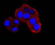 ICC staining of NUMB in Hela cells (red). Formalin fixed cells were permeabilized with 0.1% Triton X-100 in TBS for 10 minutes at room temperature and blocked with 1% Blocker BSA for 15 minutes at room temperature. Cells were probed with the primary antibody (ET1703-02, 1/50) for 1 hour at room temperature, washed with PBS. Alexa Fluor®594 Goat anti-Rabbit IgG was used as the secondary antibody at 1/1,000 dilution. The nuclear counter stain is DAPI (blue).