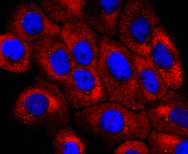 ICC staining of NUMB in A431 cells (red). Formalin fixed cells were permeabilized with 0.1% Triton X-100 in TBS for 10 minutes at room temperature and blocked with 1% Blocker BSA for 15 minutes at room temperature. Cells were probed with the primary antibody (ET1703-02, 1/50) for 1 hour at room temperature, washed with PBS. Alexa Fluor®594 Goat anti-Rabbit IgG was used as the secondary antibody at 1/1,000 dilution. The nuclear counter stain is DAPI (blue).