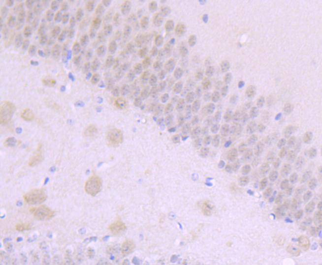 Immunohistochemical analysis of paraffin-embedded mouse brain tissue using anti-NUMB antibody. The section was pre-treated using heat mediated antigen retrieval with Tris-EDTA buffer (pH 8.0-8.4) for 20 minutes.The tissues were blocked in 5% BSA for 30 minutes at room temperature, washed with ddH2O and PBS, and then probed with the primary antibody (ET1703-02, 1/50) for 30 minutes at room temperature. The detection was performed using an HRP conjugated compact polymer system. DAB was used as the chromogen. Tissues were counterstained with hematoxylin and mounted with DPX.