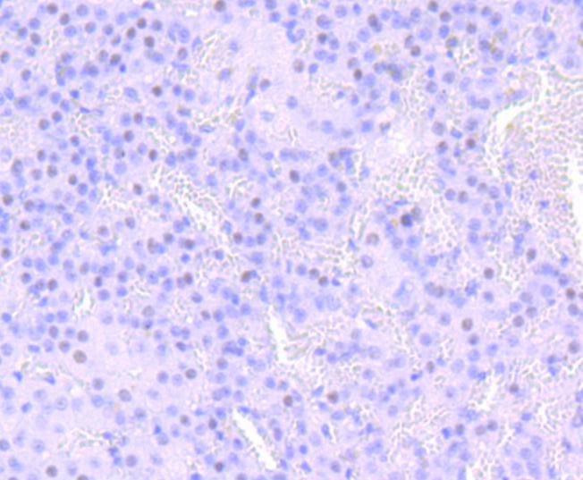 Immunohistochemical analysis of paraffin-embedded rat adrenal gland tissue using anti-NUMB antibody. The section was pre-treated using heat mediated antigen retrieval with Tris-EDTA buffer (pH 8.0-8.4) for 20 minutes.The tissues were blocked in 5% BSA for 30 minutes at room temperature, washed with ddH2O and PBS, and then probed with the primary antibody (ET1703-02, 1/50) for 30 minutes at room temperature. The detection was performed using an HRP conjugated compact polymer system. DAB was used as the chromogen. Tissues were counterstained with hematoxylin and mounted with DPX.