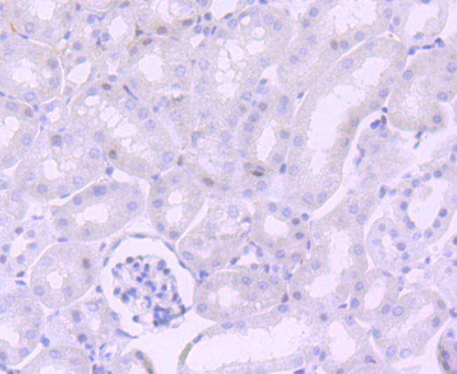 Immunohistochemical analysis of paraffin-embedded mouse kidney tissue using anti-NUMB antibody. The section was pre-treated using heat mediated antigen retrieval with Tris-EDTA buffer (pH 8.0-8.4) for 20 minutes.The tissues were blocked in 5% BSA for 30 minutes at room temperature, washed with ddH2O and PBS, and then probed with the primary antibody (ET1703-02, 1/50) for 30 minutes at room temperature. The detection was performed using an HRP conjugated compact polymer system. DAB was used as the chromogen. Tissues were counterstained with hematoxylin and mounted with DPX.