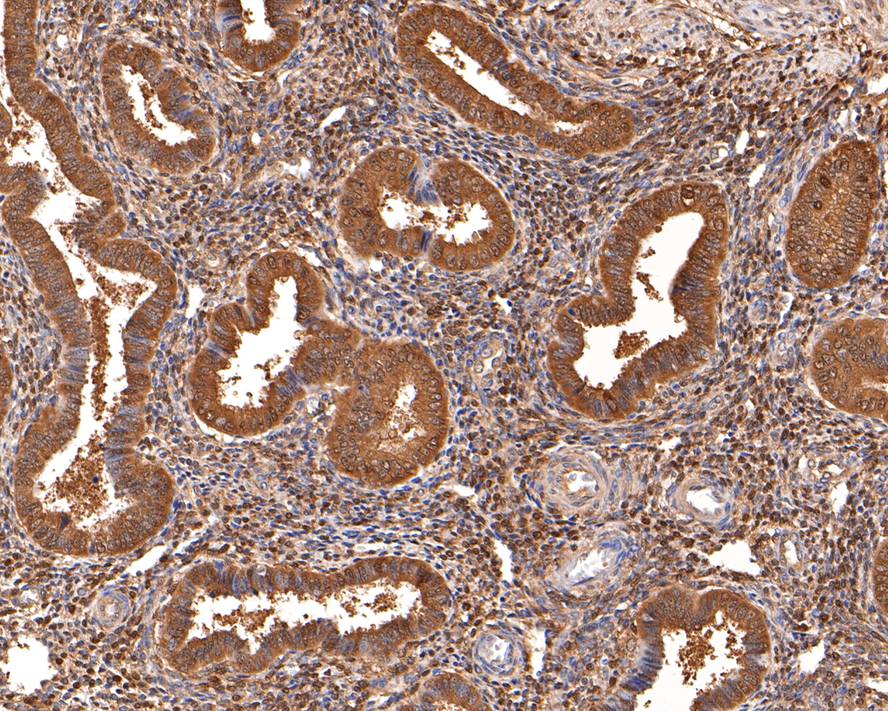 Immunohistochemical analysis of paraffin-embedded human uterus tissue with Rabbit anti-Thioredoxin antibody (ET1703-03) at 1/400 dilution.<br />
<br />
The section was pre-treated using heat mediated antigen retrieval with sodium citrate buffer (pH 6.0) for 2 minutes. The tissues were blocked in 1% BSA for 20 minutes at room temperature, washed with ddH2O and PBS, and then probed with the primary antibody (ET1703-03) at 1/400 dilution for 1 hour at room temperature. The detection was performed using an HRP conjugated compact polymer system. DAB was used as the chromogen. Tissues were counterstained with hematoxylin and mounted with DPX.