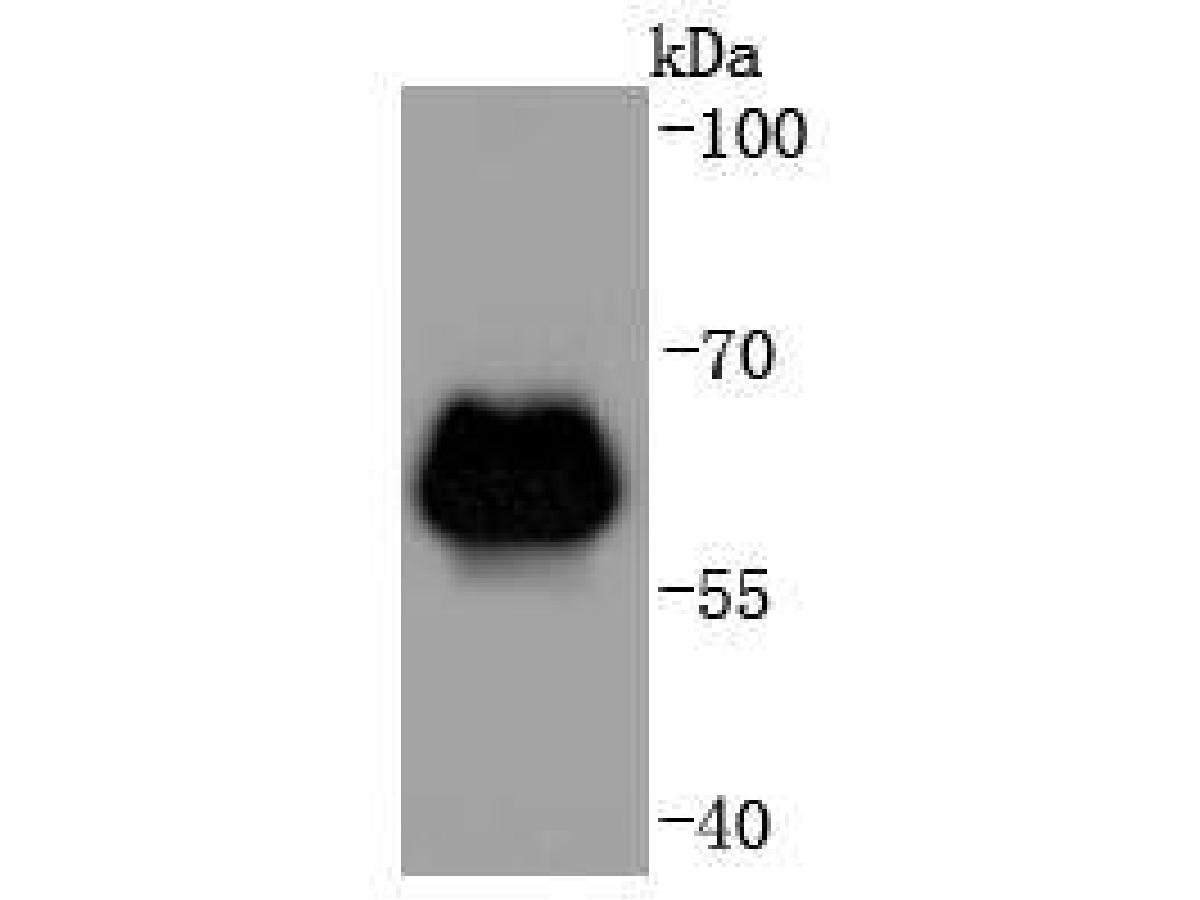 Western blot analysis of beta 2 Adrenergic Receptor on zebrafish tissue lysates. Proteins were transferred to a PVDF membrane and blocked with 5% BSA in PBS for 1 hour at room temperature. The primary antibody (ET1703-04, 1/500) was used in 5% BSA at room temperature for 2 hours. Goat Anti-Rabbit IgG - HRP Secondary Antibody (HA1001) at 1:5,000 dilution was used for 1 hour at room temperature.