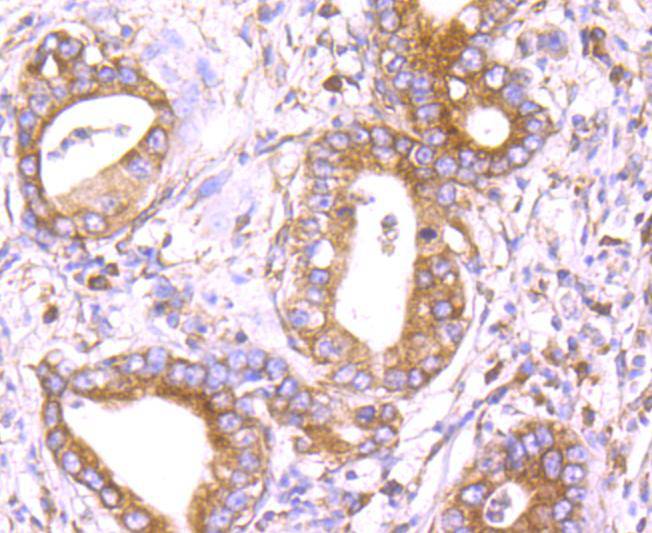 Immunohistochemical analysis of paraffin-embedded mouse pancreas tissue using anti-DDIT3 antibody. The section was pre-treated using heat mediated antigen retrieval with Tris-EDTA buffer (pH 9.0) for 20 minutes.The tissues were blocked in 5% BSA for 30 minutes at room temperature, washed with ddH2O and PBS, and then probed with the primary antibody (ET1703-05, 1/50) for 30 minutes at room temperature. The detection was performed using an HRP conjugated compact polymer system. DAB was used as the chromogen. Tissues were counterstained with hematoxylin and mounted with DPX.
