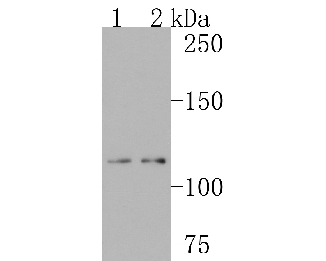 Western blot analysis of ADAM17 on different lysates. Proteins were transferred to a PVDF membrane and blocked with 5% BSA in PBS for 1 hour at room temperature. The primary antibody (ET1703-06, 1/500) was used in 5% BSA at room temperature for 2 hours. Goat Anti-Rabbit IgG - HRP Secondary Antibody (HA1001) at 1:200,000 dilution was used for 1 hour at room temperature.<br />
Positive control: <br />
Lane 1: SW480 cell lysate<br />
Lane 2: HepG2 cell lysate