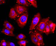 ICC staining of ADAM17 in HepG2 cells (red). Formalin fixed cells were permeabilized with 0.1% Triton X-100 in TBS for 10 minutes at room temperature and blocked with 1% Blocker BSA for 15 minutes at room temperature. Cells were probed with the primary antibody (ET1703-06, 1/50) for 1 hour at room temperature, washed with PBS. Alexa Fluor®594 Goat anti-Rabbit IgG was used as the secondary antibody at 1/1,000 dilution. The nuclear counter stain is DAPI (blue).