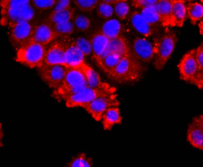 ICC staining of ADAM17 in SW480 cells (red). Formalin fixed cells were permeabilized with 0.1% Triton X-100 in TBS for 10 minutes at room temperature and blocked with 1% Blocker BSA for 15 minutes at room temperature. Cells were probed with the primary antibody (ET1703-06, 1/50) for 1 hour at room temperature, washed with PBS. Alexa Fluor®594 Goat anti-Rabbit IgG was used as the secondary antibody at 1/1,000 dilution. The nuclear counter stain is DAPI (blue).
