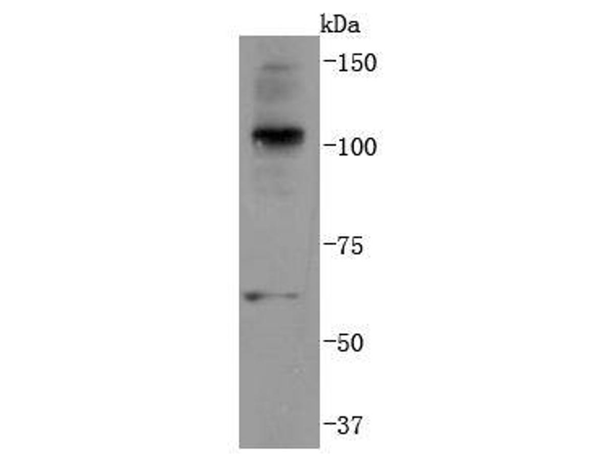 Western blot analysis of K63-linkage Specific Ubiquitin on Hela cells lysates using anti-K63-linkage Specific Ubiquitin antibody at 1/1,000 dilution.