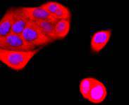 ICC staining K63-linkage Specific Ubiquitin in Hela cells (red). The nuclear counter stain is DAPI (blue). Cells were fixed in paraformaldehyde, permeabilised with 0.25% Triton X100/PBS.