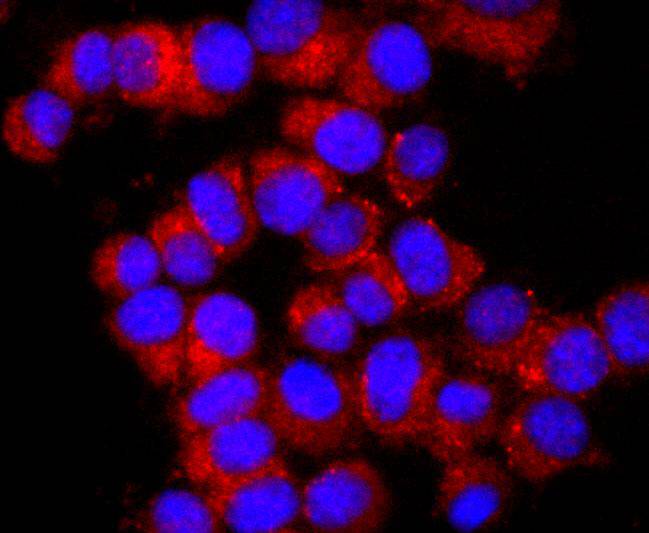 ICC staining K63-linkage Specific Ubiquitin in N2A cells (red). The nuclear counter stain is DAPI (blue). Cells were fixed in paraformaldehyde, permeabilised with 0.25% Triton X100/PBS.