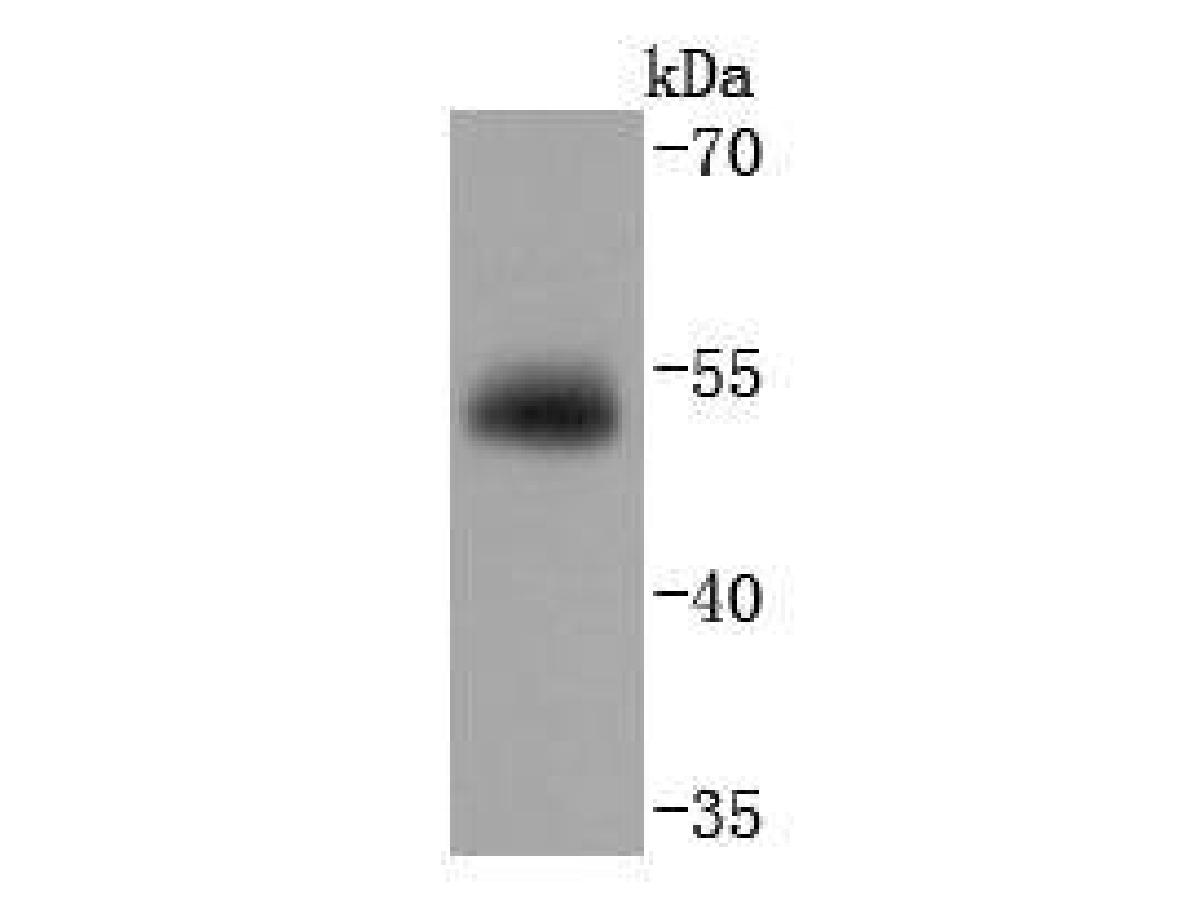 Western blot analysis of Vitamin D Binding protein on human lung tissue lysates. Proteins were transferred to a PVDF membrane and blocked with 5% BSA in PBS for 1 hour at room temperature. The primary antibody (ET1703-09, 1/500) was used in 5% BSA at room temperature for 2 hours. Goat Anti-Rabbit IgG - HRP Secondary Antibody (HA1001) at 1:200,000 dilution was used for 1 hour at room temperature.<br />
<br />
Predicted band size: 53 kDa<br />
Observed band size: 53 kDa