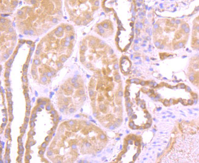 Immunohistochemical analysis of paraffin-embedded human kidney tissue using anti-Vitamin D Binding protein antibody. The section was pre-treated using heat mediated antigen retrieval with Tris-EDTA buffer (pH 9.0) for 20 minutes.The tissues were blocked in 1% BSA for 30 minutes at room temperature, washed with ddH2O and PBS, and then probed with the primary antibody (ET1703-09, 1/50) for 30 minutes at room temperature. The detection was performed using an HRP conjugated compact polymer system. DAB was used as the chromogen. Tissues were counterstained with hematoxylin and mounted with DPX.
