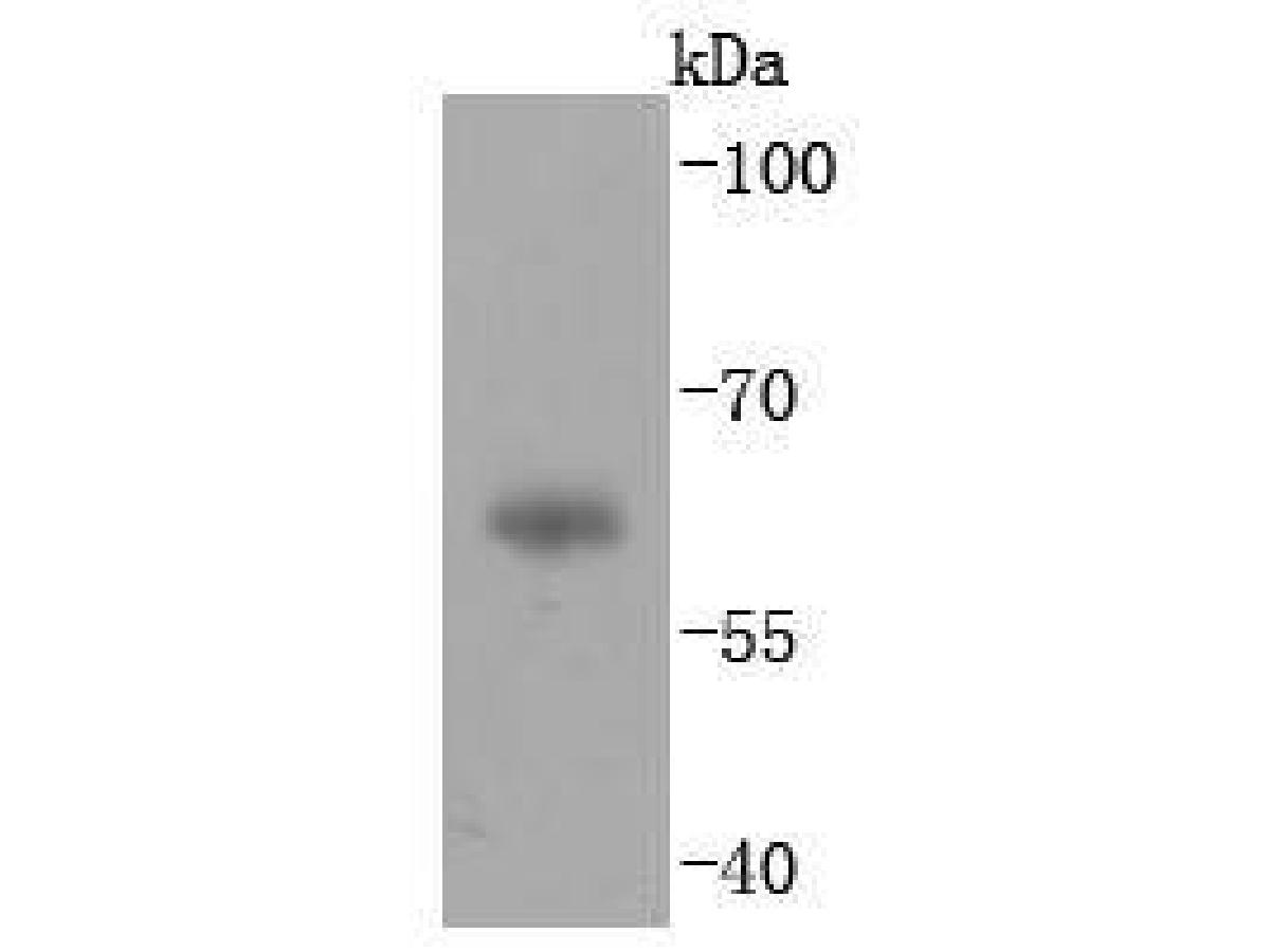Western blot analysis of IgA on human plasma lysates. Proteins were transferred to a PVDF membrane and blocked with 5% BSA in PBS for 1 hour at room temperature. The primary antibody (ET1703-10, 1/500) was used in 5% BSA at room temperature for 2 hours. Goat Anti-Rabbit IgG - HRP Secondary Antibody (HA1001) at 1:5,000 dilution was used for 1 hour at room temperature.<br />
<br />
Predicted band size: 38 kDa<br />
Observed band size: 60 kDa