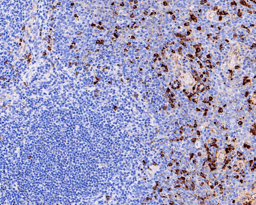ICC staining of IgA in HepG2 cells (red). Formalin fixed cells were permeabilized with 0.1% Triton X-100 in TBS for 10 minutes at room temperature and blocked with 1% Blocker BSA for 15 minutes at room temperature. Cells were probed with the primary antibody (ET1703-10, 1/50) for 1 hour at room temperature, washed with PBS. Alexa Fluor®594 Goat anti-Rabbit IgG was used as the secondary antibody at 1/1,000 dilution. The nuclear counter stain is DAPI (blue).