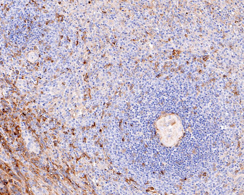 Immunohistochemical analysis of paraffin-embedded human tonsil tissue using anti-IgA antibody. The section was pre-treated using heat mediated antigen retrieval with Tris-EDTA buffer (pH 8.0-8.4) for 20 minutes.The tissues were blocked in 5% BSA for 30 minutes at room temperature, washed with ddH2O and PBS, and then probed with the primary antibody (ET1703-10, 1/200) for 30 minutes at room temperature. The detection was performed using an HRP conjugated compact polymer system. DAB was used as the chromogen. Tissues were counterstained with hematoxylin and mounted with DPX.