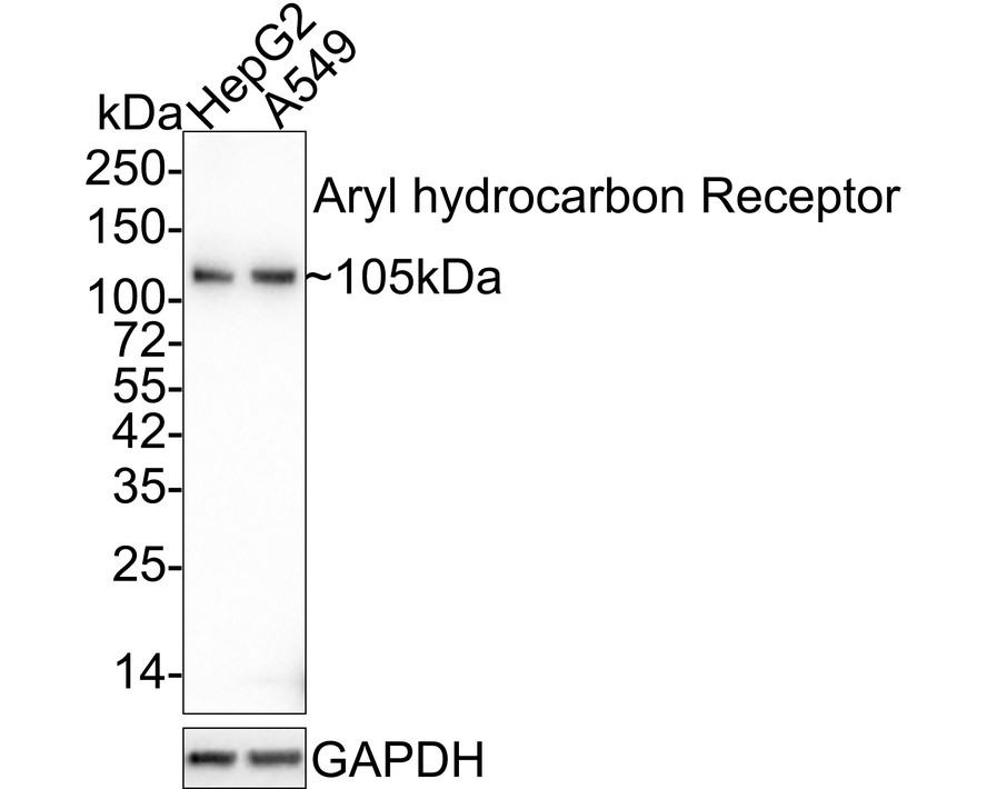 Western blot analysis of Aryl hydrocarbon Receptor on human lung tissue lysates. Proteins were transferred to a PVDF membrane and blocked with 5% BSA in PBS for 1 hour at room temperature. The primary antibody (ET1703-11, 1/500) was used in 5% BSA at room temperature for 2 hours. Goat Anti-Rabbit IgG - HRP Secondary Antibody (HA1001) at 1:200,000 dilution was used for 1 hour at room temperature.