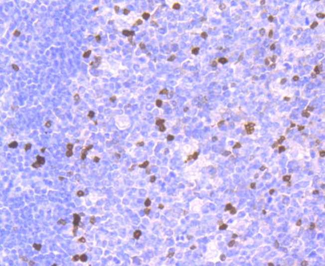 Immunohistochemical analysis of paraffin-embedded human tonsil tissue using anti-Parvalbumin antibody. The section was pre-treated using heat mediated antigen retrieval with Tris-EDTA buffer (pH 9.0) for 20 minutes.The tissues were blocked in 1% BSA for 30 minutes at room temperature, washed with ddH2O and PBS, and then probed with the primary antibody (ET1703-15, 1/50) for 30 minutes at room temperature. The detection was performed using an HRP conjugated compact polymer system. DAB was used as the chromogen. Tissues were counterstained with hematoxylin and mounted with DPX.