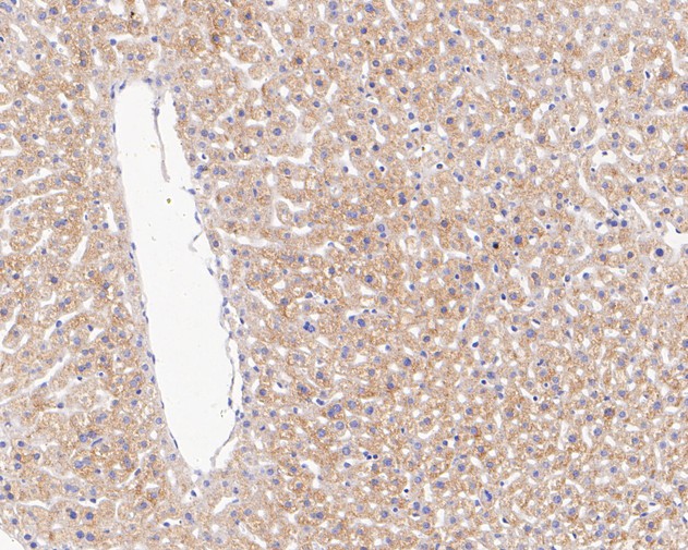 Immunohistochemical analysis of paraffin-embedded mouse liver tissue using anti-Interferon gamma antibody. The section was pre-treated using heat mediated antigen retrieval with Tris-EDTA buffer (pH 9.0) for 20 minutes.The tissues were blocked in 5% BSA for 30 minutes at room temperature, washed with ddH2O and PBS, and then probed with the primary antibody (ET1703-17, 1/50) for 30 minutes at room temperature. The detection was performed using an HRP conjugated compact polymer system. DAB was used as the chromogen. Tissues were counterstained with hematoxylin and mounted with DPX.