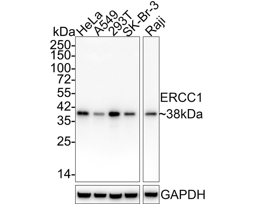 Western blot analysis of ERCC1 on different lysates using anti-ERCC1 antibody at 1/1,000 dilution.<br />
Positive control:   <br />
Lane 1: Hela cell lysates<br />
Lane 2: Human lung tissue lysates<br />
Lane 3: 293T cell lysates<br />
Lane 4: A549 cell lysates