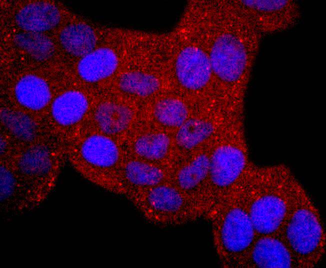 ICC staining ERCC1 in Hela cells (red). The nuclear counter stain is DAPI (blue). Cells were fixed in paraformaldehyde, permeabilised with 0.25% Triton X100/PBS.