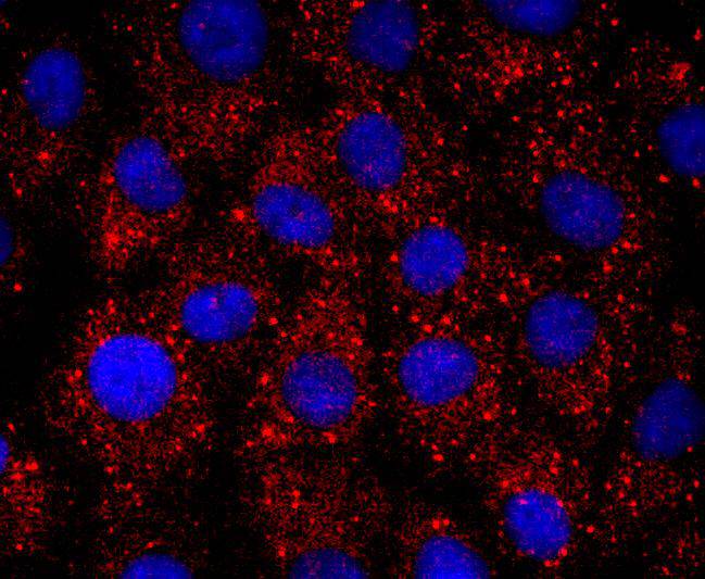 ICC staining ERCC1 in A549 cells (red). The nuclear counter stain is DAPI (blue). Cells were fixed in paraformaldehyde, permeabilised with 0.25% Triton X100/PBS.