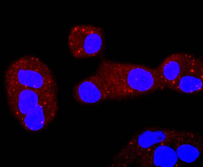 ICC staining ERCC1 in PANC-1 cells (red). The nuclear counter stain is DAPI (blue). Cells were fixed in paraformaldehyde, permeabilised with 0.25% Triton X100/PBS.