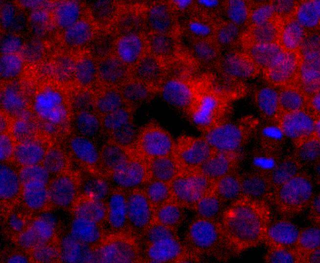 ICC staining ERCC1 in 293T cells (red). The nuclear counter stain is DAPI (blue). Cells were fixed in paraformaldehyde, permeabilised with 0.25% Triton X100/PBS.